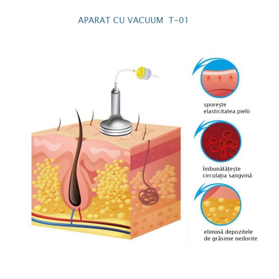 Aparat de terapie cu vacuum Т-01