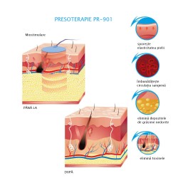 Aparat de presoterapie PR-901