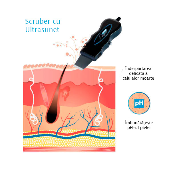 Scruber cu ultrasunete T-02