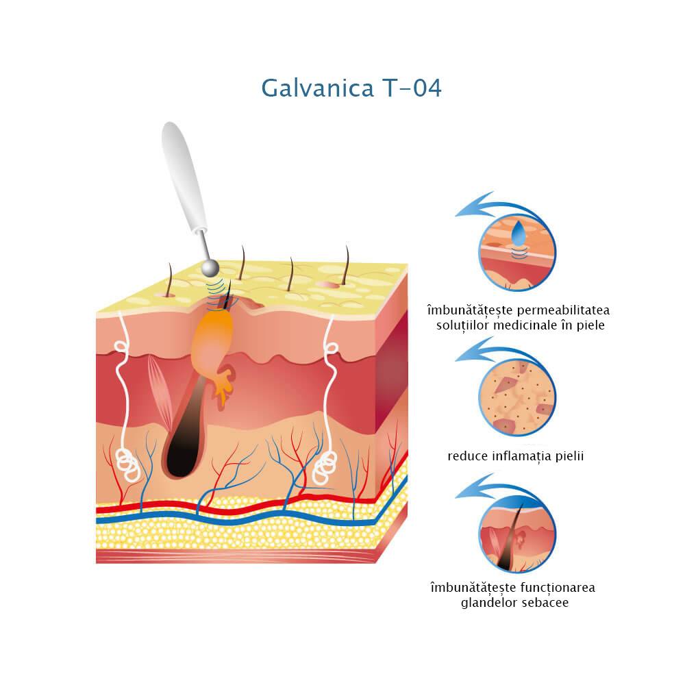 Aparate de galvanizare T-04
