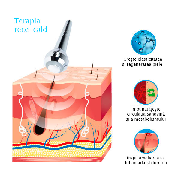 Aparat de termoterapie T-05