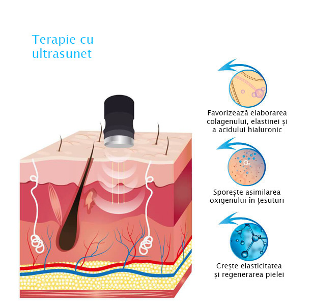 Aparat de terapie cu ultrasunete T-11